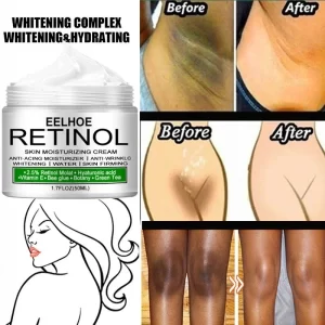 Crema blanqueadora corporal para las partes privadas