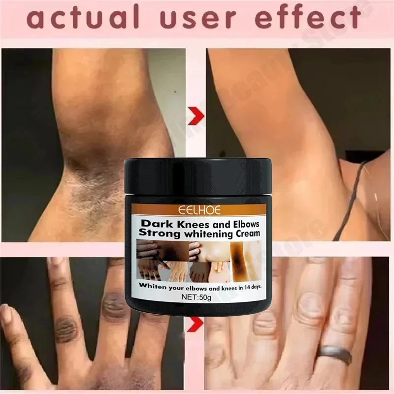 Crema para blanquear el cuerpo, partes privadas - Imagen 4