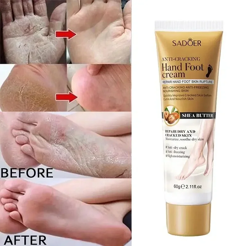 Crema antigrietas para manos y pies,reparación - Imagen 5