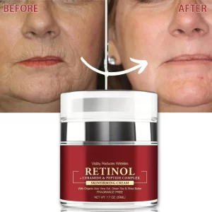 Crema de Retinol instantánea, eliminador de arrugas