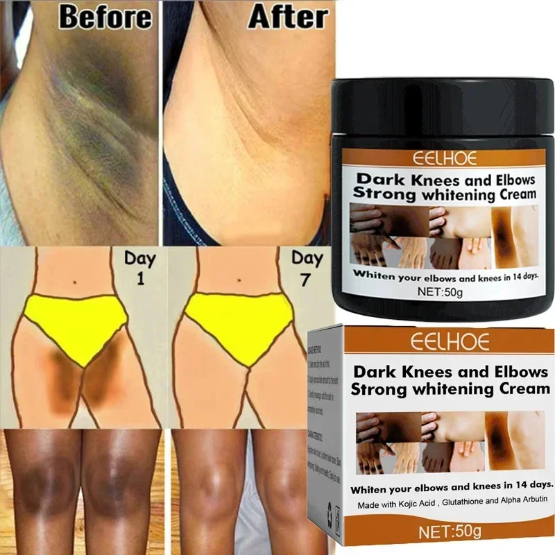 Crema para blanquear el cuerpo, partes privadas