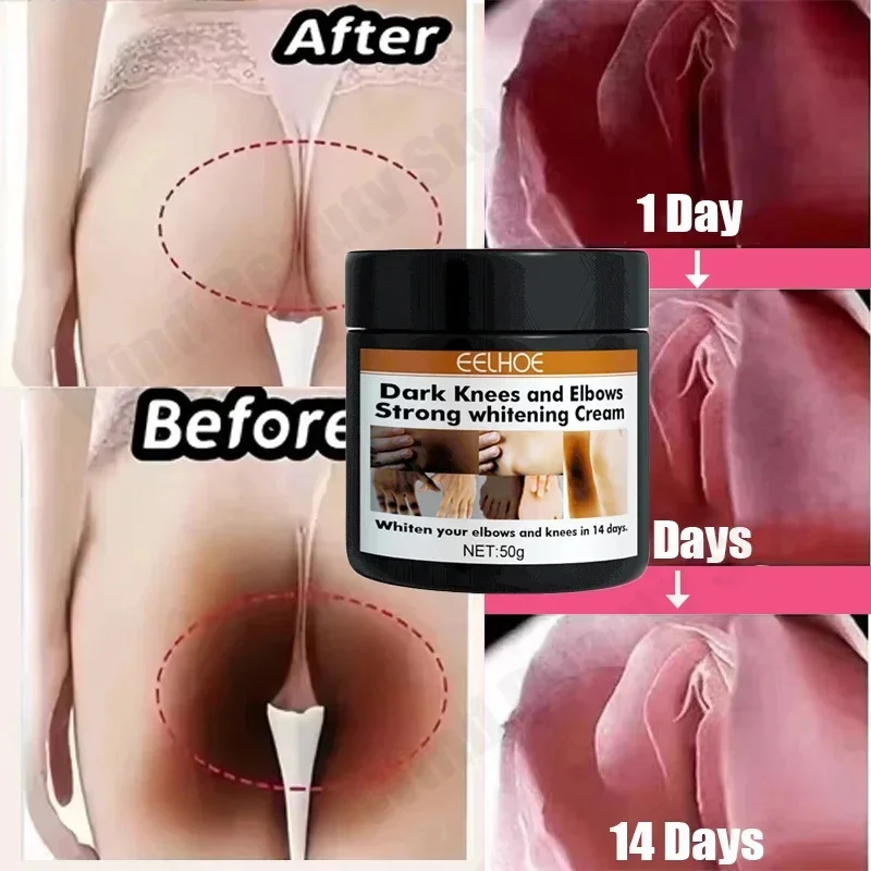 Crema para blanquear el cuerpo, partes privadas - Imagen 3